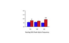 Effects of the Nootropic Compound Alpha BRAIN on ERP and EEG Measures of Cognitive Performance