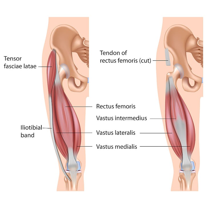 The Best Quad Stretches & Exercises to Fit Into Your Workout